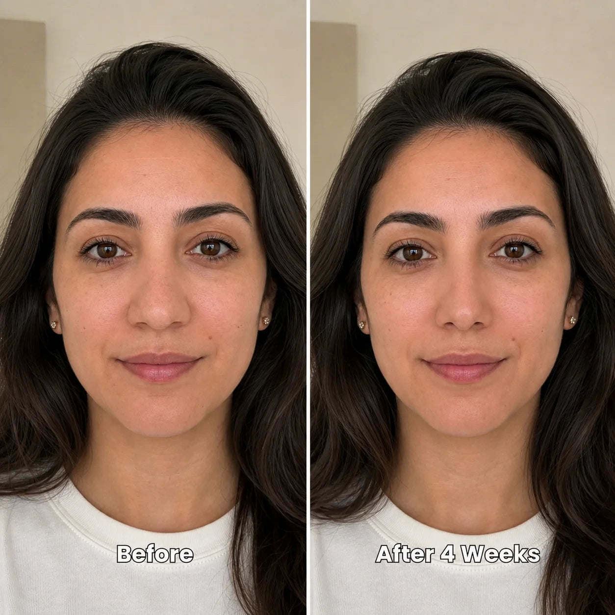 Zenvelle Nose Contour™ - Slimmer Nose, No Surgery