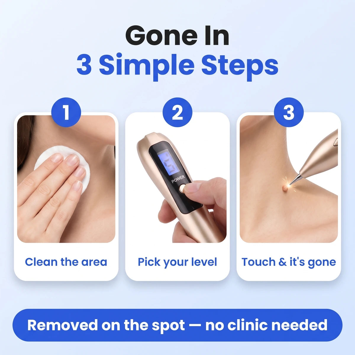 Before and after skin tag removal
