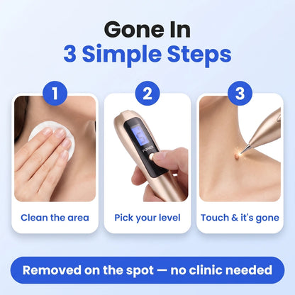The Nuzzie Pen - Remove Imperfections, Instantly!